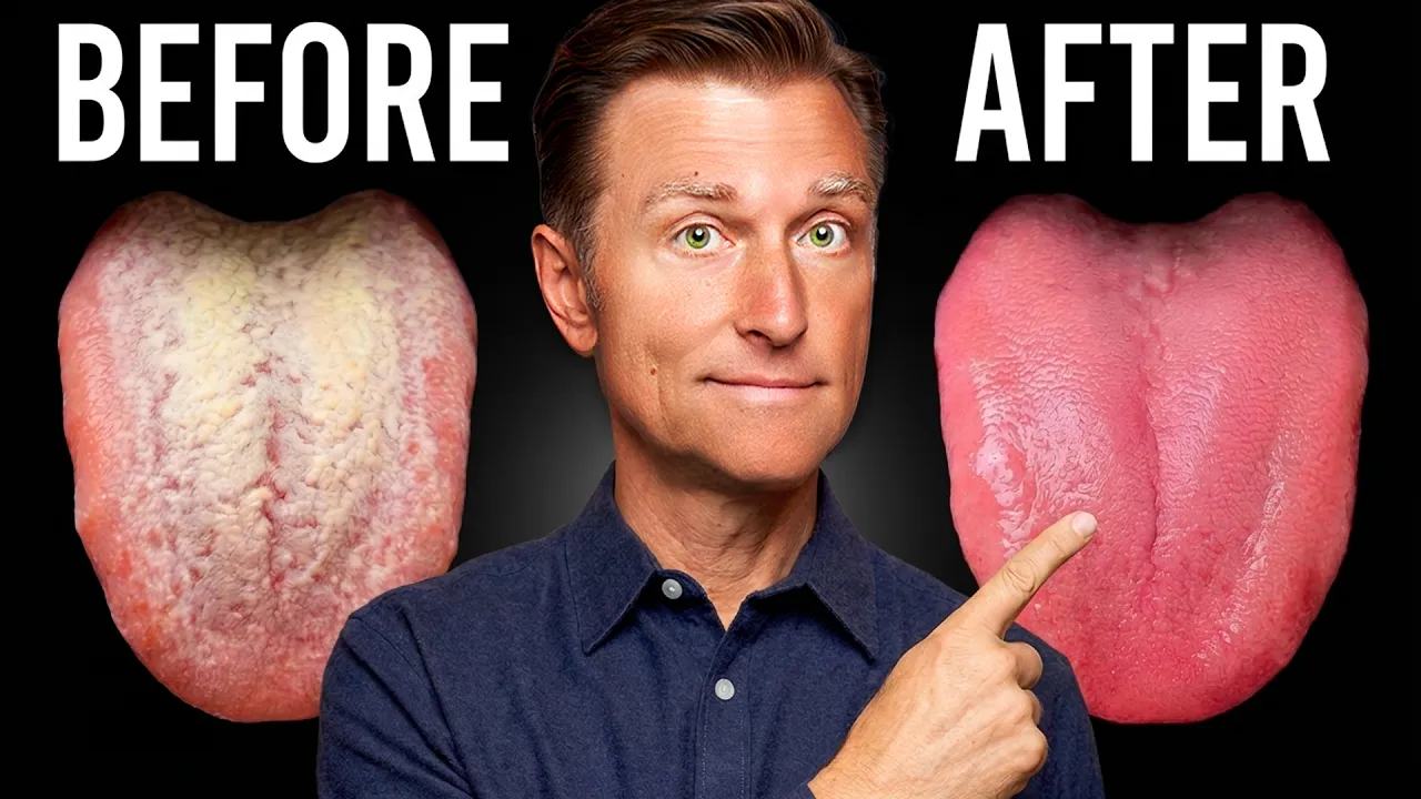 How to Get Rid of Candida in 24 Hours (And Keep It Gone) thumbnail