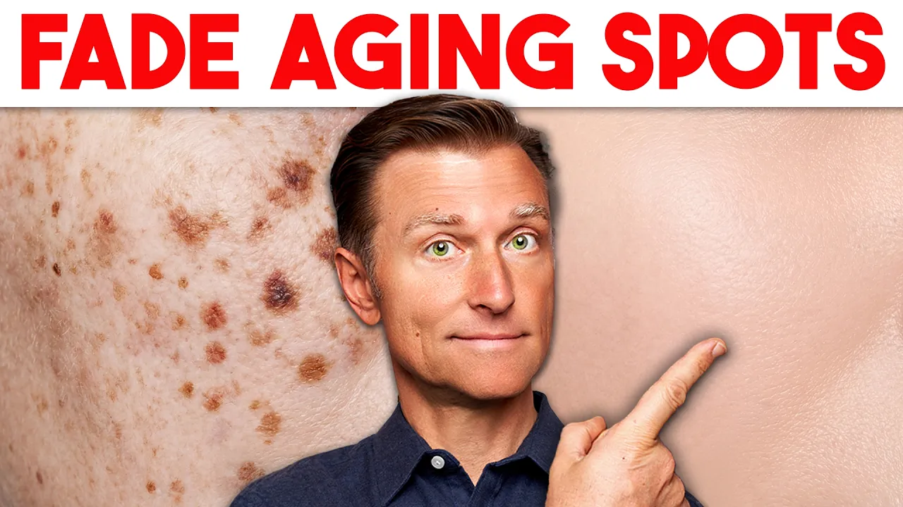 Age Spots Are NOT Normal Aging thumbnail